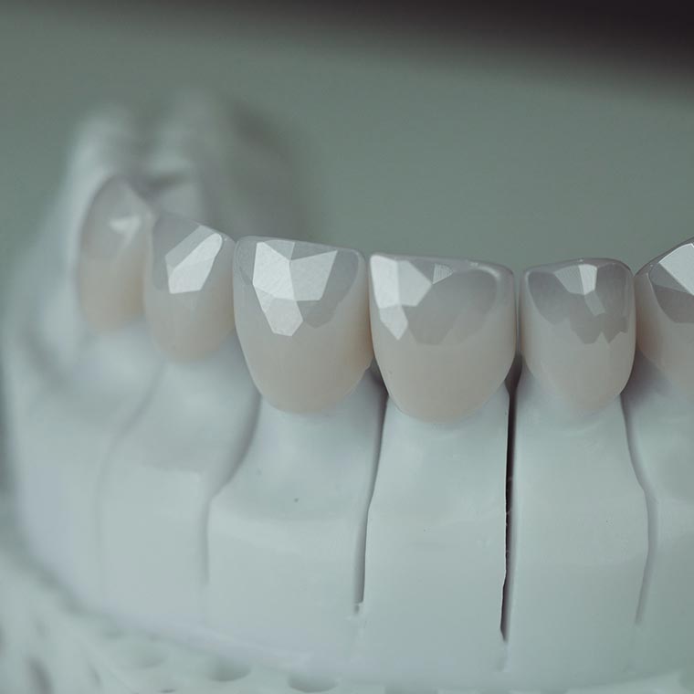 Срок службы от 15 лет, с сохранением формы и эстетического эффекта