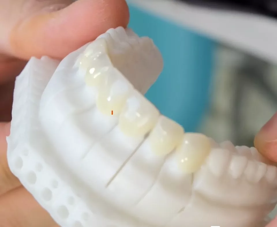 Вся правда о ювенирах: ставить или нет?