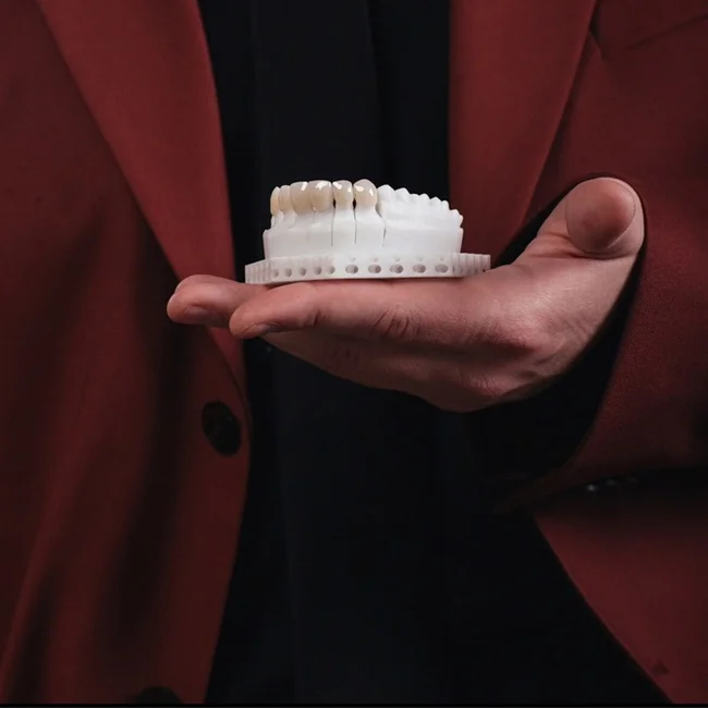 Ювениры: что говорят реальные люди об уникальных коронках с бриллиантовым блеском