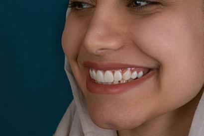 Когда нужен ирригатор: показания и противопоказания