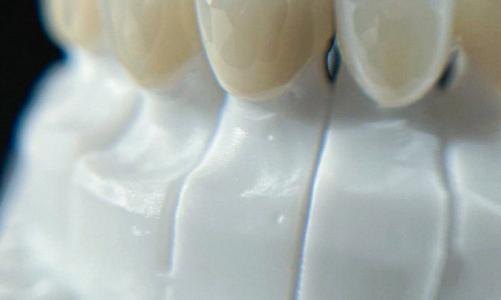 Заключение Ювениры – это не просто модный тренд, а новое слово в эстетической стоматологии