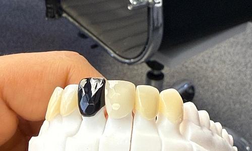 «Овечкин смайл»: фанаты хоккеиста обращаются в клинику, чтобы сделать себе улыбку как у кумира