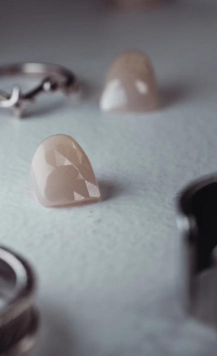 Как делают и как крепятся ювениры на зубы: виды, цены, установка, уход — полное руководство