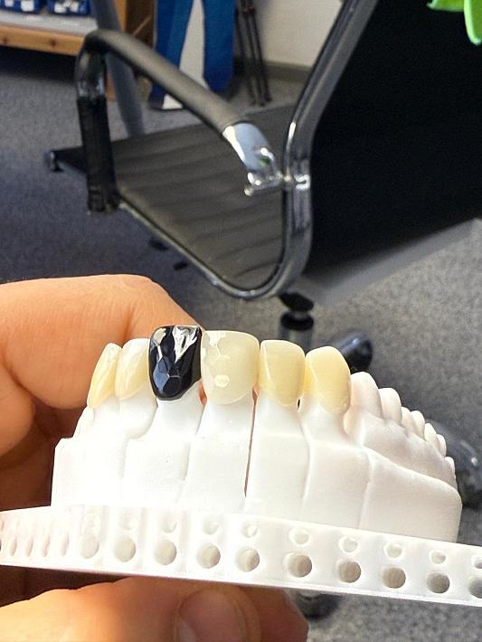 «Овечкин смайл»: фанаты хоккеиста обращаются в клинику, чтобы сделать себе улыбку как у кумира